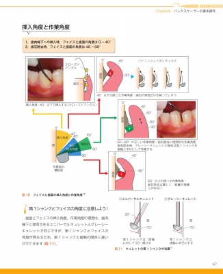 歯周病を治すSRP できる歯科衛生士のスキルと知識 月刊デンタル