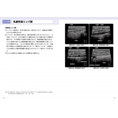 乳房アトラス コンパクト超音波neo : 佐久間浩 | HMV&BOOKS online 