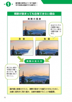 緑内障 眼科 英語 本 Amazon.co.jp: All About 原発閉塞隅角緑内障 (眼科臨床