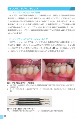 歯科臨床まずはここから! 歯周治療 卒後5年を支えるスタートガイド
