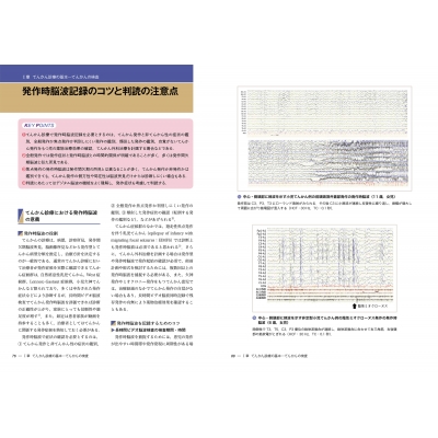 新分類・新薬でわかる 小児けいれん・てんかん診療