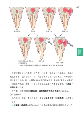 歯内治療学 歯科国試パーフェクトマスター : 前田博史 | HMVu0026BOOKS online - 9784263458778