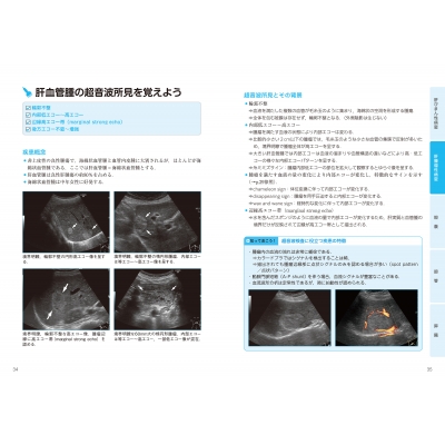超音波検査士認定試験対策:臨床編 消化器領域・健診領域 : 東京超音波 