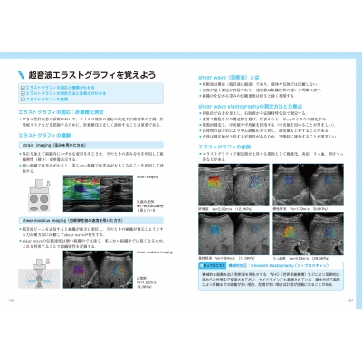 超音波検査士認定試験対策: 臨床編 消化器領域+健診領域 Book 1 ...