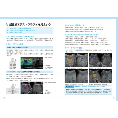 超音波検査士認定試験対策:臨床編 消化器領域・健診領域 : 東京超音波研究会如月会 | HMV&BOOKS online - 9784907909215