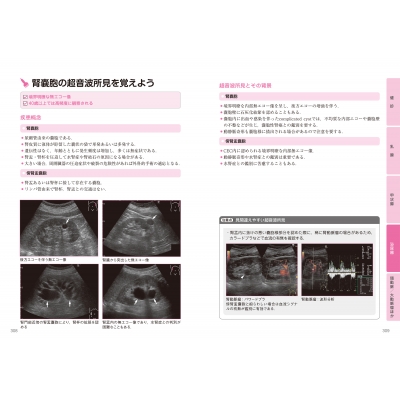 超音波検査士認定試験対策:臨床編 消化器領域・健診領域 : 東京超音波研究会如月会 | HMV&BOOKS online - 9784907909215