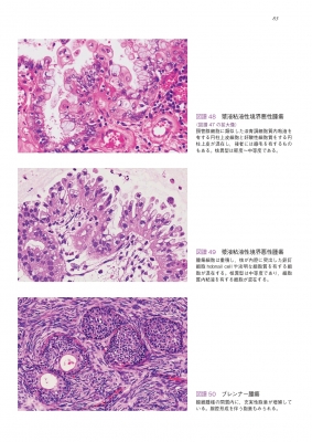 卵巣腫瘍・卵管癌・腹膜癌　改訂・改題第2版(腫瘍病理鑑別診断アトラス 卵巣腫瘍・卵管癌・腹膜癌 改訂・改題第2版(腫瘍病理鑑別診断