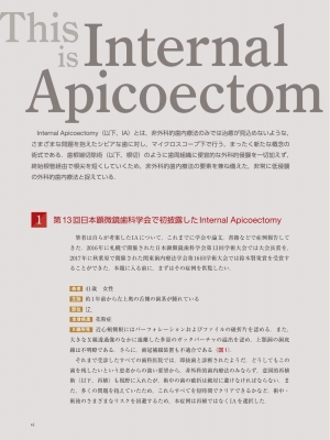 Internal Apicoectomy マイクロスコープ下で行う外科・非外科融合の 