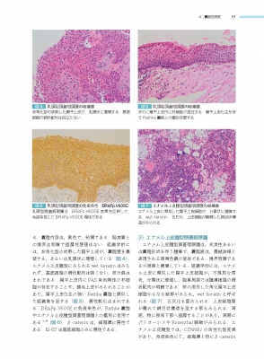 内分泌臓器 (非腫瘍性疾患病理アトラス)非腫瘍性疾患病理アトラス