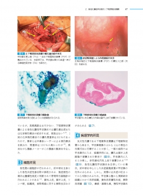 内分泌臓器 (非腫瘍性疾患病理アトラス)非腫瘍性疾患病理アトラス