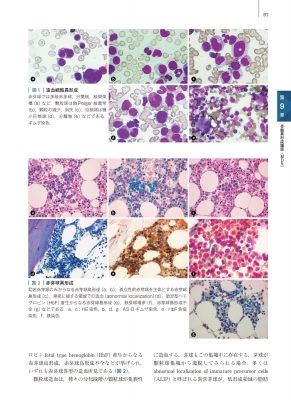 骨髄組織病理学 骨髄標本の見方と考え方 骨髄組織病理学 骨髄標本の見方と考え方 | 伊藤 雅文, 中村 直哉
