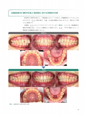 実践的リンガルブラケット矯正 [新品]-