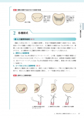 必携!術後心エコーガイドブック 術式イラストと実例から学ぶ評価の