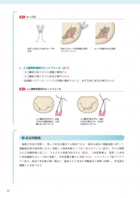必携!術後心エコーガイドブック 術式イラストと実例から学ぶ評価のポイント 必携！術後心エコーガイドブック 術式イラストと実例から学ぶ
