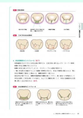 必携!術後心エコーガイドブック 術式イラストと実例から学ぶ評価の