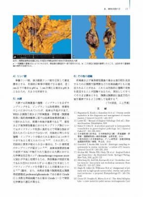 子宮腫瘍病理アトラス | 石倉 浩 |本 | 通販 | Amazon