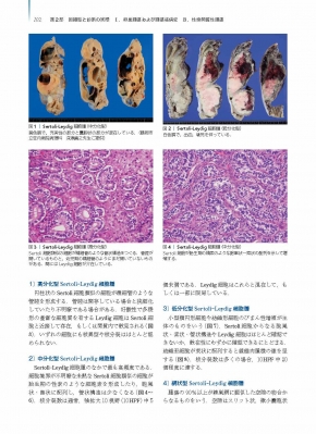 卵巣腫瘍・卵管癌・腹膜癌 腫瘍病理鑑別診断アトラス : 清川貴子