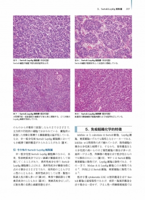卵巣腫瘍・卵管癌・腹膜癌 腫瘍病理鑑別診断アトラス : 清川貴子