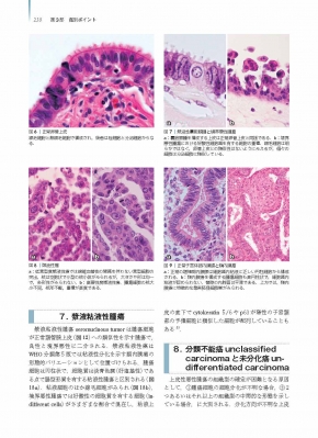 卵巣腫瘍・卵管癌・腹膜癌 腫瘍病理鑑別診断アトラス : 清川貴子 卵巣腫瘍・卵管癌・腹膜癌 腫瘍病理鑑別診断アトラス : 清川貴子