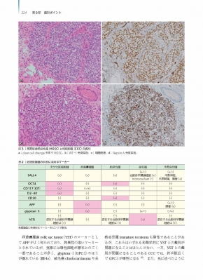 子宮腫瘍病理アトラス | 石倉 浩 |本 | 通販 | Amazon