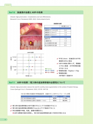 エビデンスに基づいたインプラント治療・骨造成 Early Failure