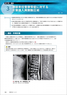 脊椎手術パーフェクト : 大鳥精司 | HMV&BOOKS online - 9784758112697