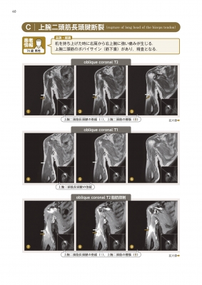 上肢mri読影の一手 2708画像からみた定跡 : 佐粧孝久