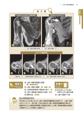 上肢mri読影の一手 2708画像からみた定跡 : 佐粧孝久