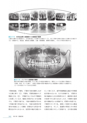 歯科放射線学 第7版 : 岡野友宏 | HMV&BOOKS online - 9784263456811