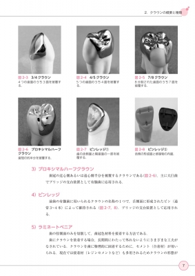 最新歯科技工士教本　有床義歯技工学　第2版 最新歯科技工士教本 有床義歯技工学 第2版/医歯薬出版株式会社