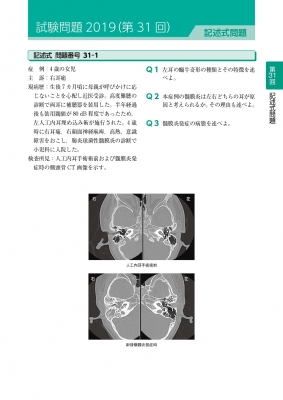 耳鼻咽喉科専門医認定試験 2019-2023 問題と解答 : 日本耳鼻咽喉