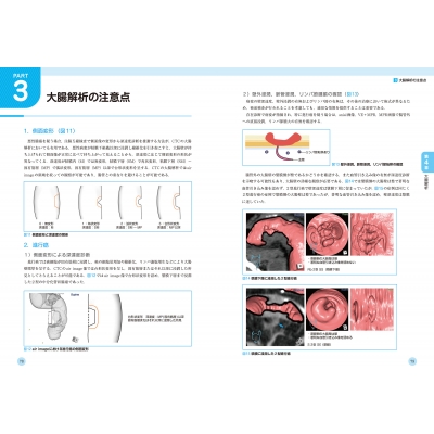 公式の店舗 大腸ct検査-実務・症例・基礎知識-イチから学ぶ! : 東海 語学・辞書・学習参考書