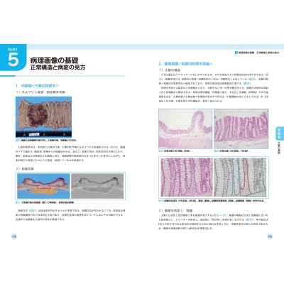 大腸ct検査-実務・症例・基礎知識-イチから学ぶ! : 東海