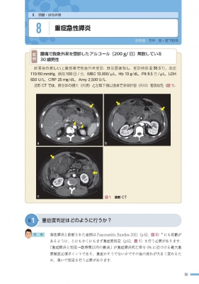 実況カンファレンス 胆膵診療エキスパートの勘どころ : 中井陽介