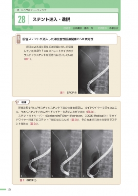 実況カンファレンス 胆膵診療エキスパートの勘どころ : 中井陽介