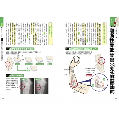 投球障害0へ! ゼロポジションでつくる最強の肩と肘 : 西中直也