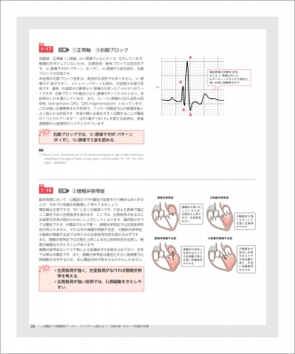心電図7日間最強ブースト_心電図完全攻略マニュアル_\"2冊セット\" 心電図7日間最強ブースト_心電図完全攻略マニュアル_