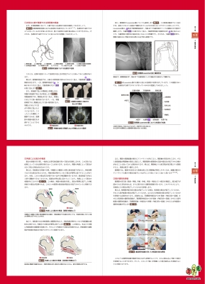 赤羽根良和の臨床 股関節 : 赤羽根良和 | HMV&BOOKS online