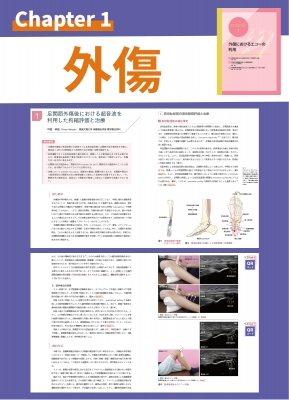 理学療法超音波学 Vol.4 : 日本運動器理学療法超音波フォーラム