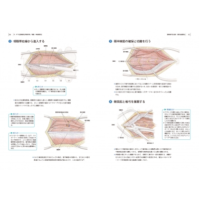 頚椎 胸椎の手術 Dvd付 整形外科手術イラストレイテッド 鐙邦芳 Hmv Books Online