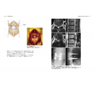 頚椎 胸椎の手術 Dvd付 整形外科手術イラストレイテッド 鐙邦芳 Hmv Books Online