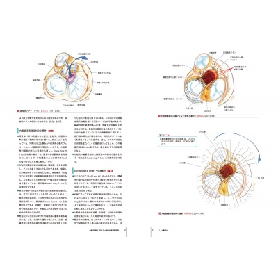 弁膜症の手術 心臓血管外科手術エクセレンス : 高梨秀一郎 | HMV&BOOKS