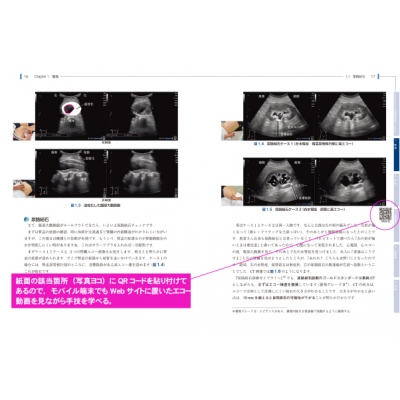 離島発 とって隠岐の エコーで変わる外来診療 当てれば見える、見えるとわかる、わかるから面白い Amazon.co.jp: 離島発 とって隠岐の エコーで変わる外来診療