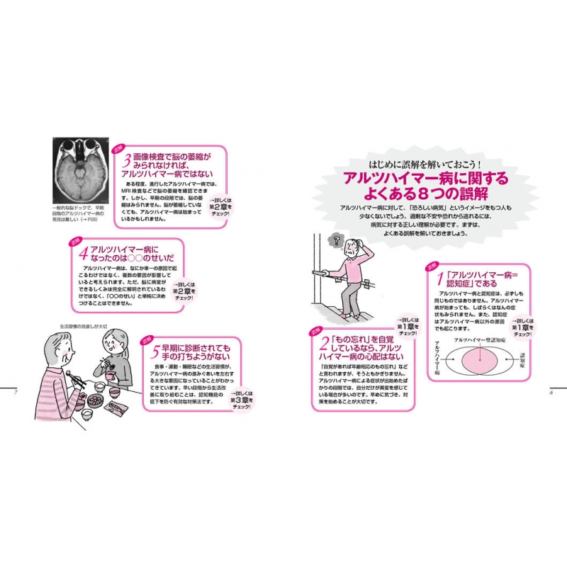 アルツハイマー病のことがわかる本 健康ライブラリー イラスト版 新井平伊 Hmv Books Online